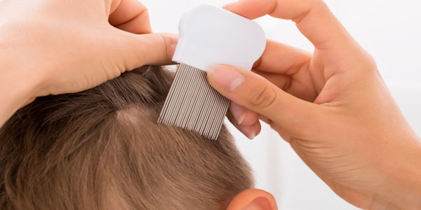 برای از بین بردن شپش سر بچه چه باید کرد؟