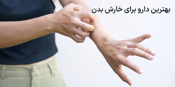 بهترین دارو برای خارش بدن