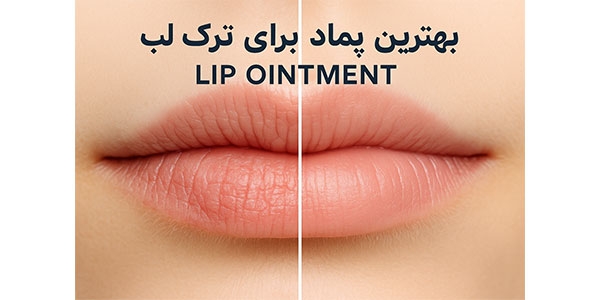 بهترین پماد برای ترک لب